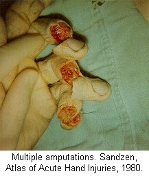 finger.jpg